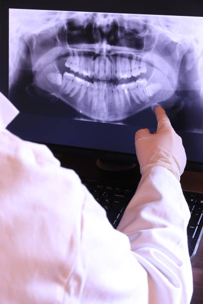 Best Emergency Dentist for Lost Fillings or Crowns in Stockbridge, GA